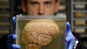 İnsan kafatasında yeni bir organ bulundu