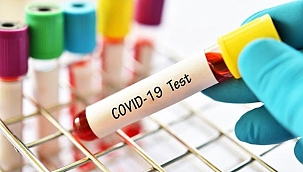 Covid Test Paraları İade Edilecek