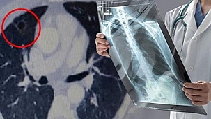 Koronavirüs geçirenlerin akciğerlerini güçlendiren nefes egzersizleri!