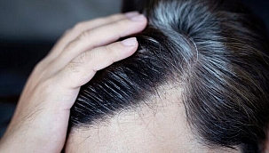 Beyaz saçlardan kurtulmanın doğal yolu! Çöpe attığınız her gün için pişman olacaksınız