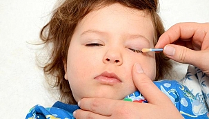 Herkesin yaptığı hata! Önce enfeksiyon başlıyor sonra...