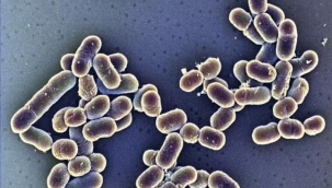 Marketlerden 60 markanın ürünü toplatıldı! Can kayıplarına yol açan 'listeria' salgını alarmı: Özellikle o kişiler tehlikede...