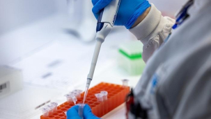 Avrupa'da Maymun çiçeği alarmı! 