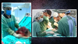 Yıllarca karnında taşımış! Tam 10 kilo... Karın ağrısı şikayetiyle hastaneye gitmese fark etmeyecekti